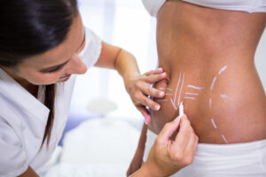 Nurse marks a patient’s back with white surgical lines in preparation for a procedure.