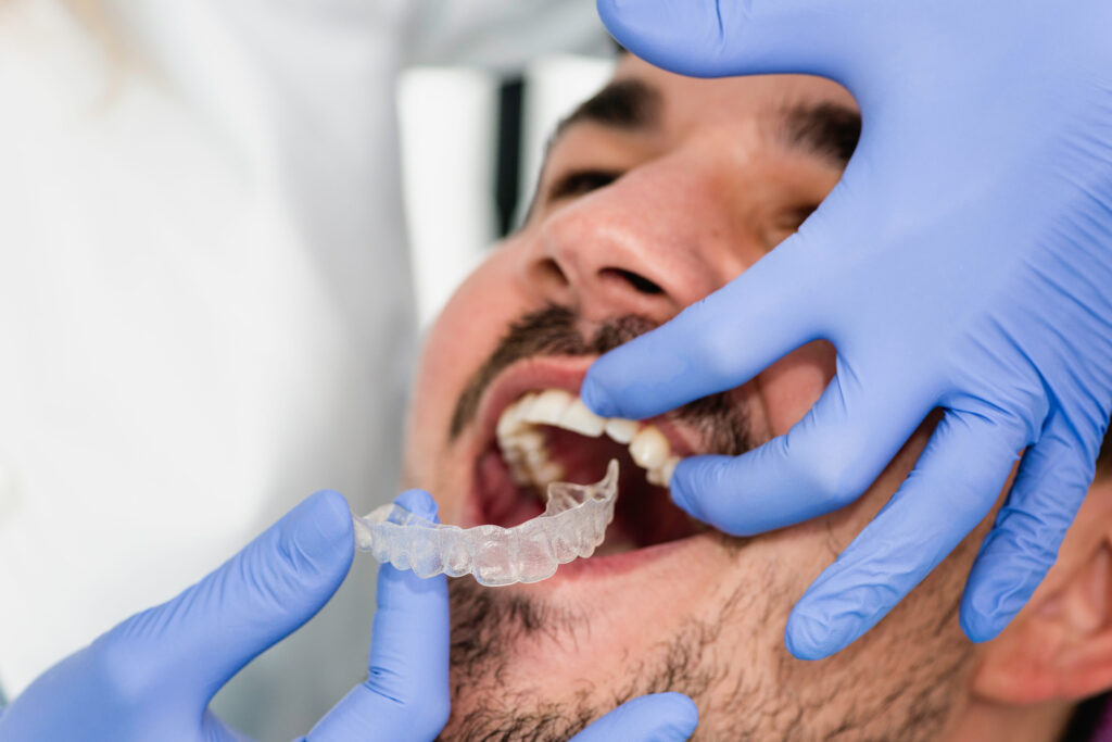 Gloved hands insert a clear dental aligner into a man's mouth during a dental exam/adjustment.